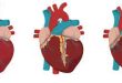 Kalp Krizi Testi Nedir?