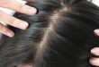 Ankara Saç Kök Hücre: Saç Güzelliğinizin Yeniden Canlanması