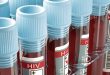 Hiv Testi Hayat Kurtarır