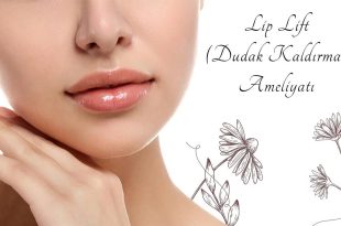 Lip Lift ile Yüzünüz Gençleşsin