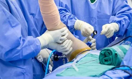 Ön Çapraz Bağ Kopması: Belirtilerden Tedaviye, Ameliyat Süreci ve İyileşme Yol Haritası
